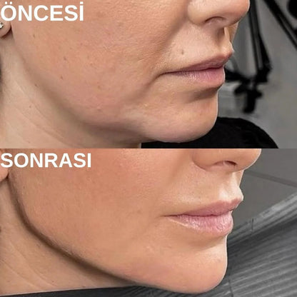 Doğum Sonrası 4'lü Toparlayıcı Set